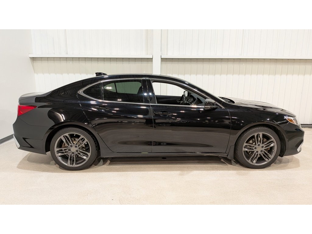 Acura TLX 2018 Noir Val-David - photo #6