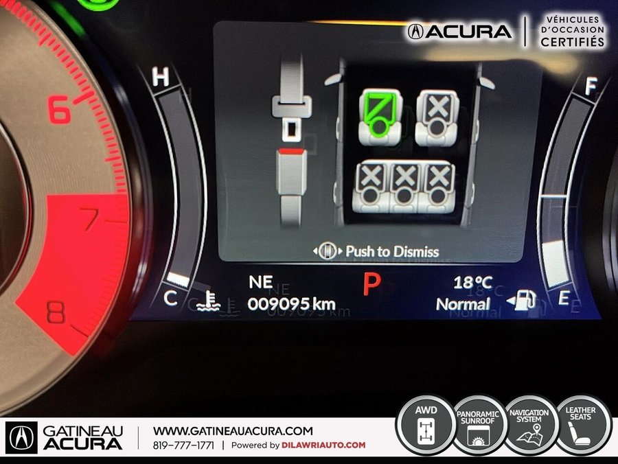 2025 Acura RDX A-Spec SH-AWD Grey